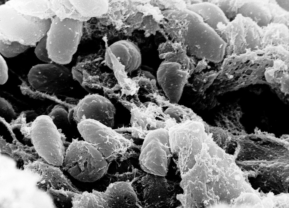 Палочка Yersinia pestis
