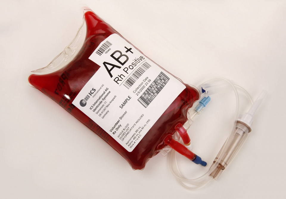 Упаковка с цельной кровью группы AB (IV) Rh+